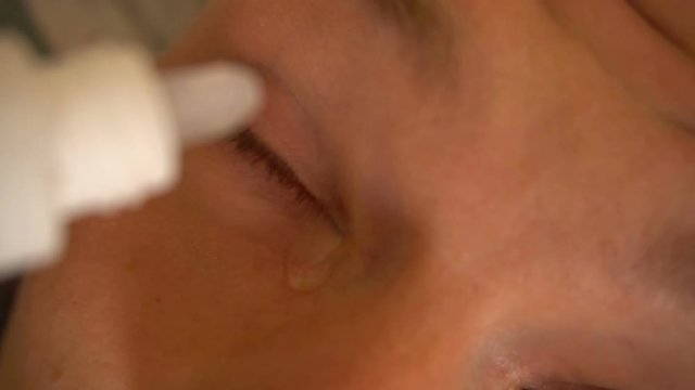 Close up of an eye of a child receiving medicine, eye drop.