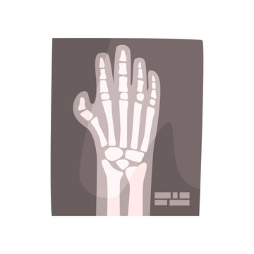 X ray image of human hand cartoon vector Illustration