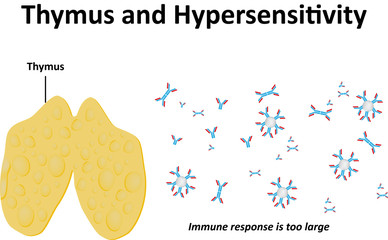 Thymus and Hypersensitivity