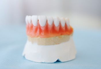 Gypsum models of dentures on the table close-up. Dental prosthetics, orthopedic dentistry