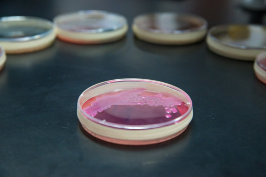 Close-up Detail Of An Agar Plate Of Klebsiella Pneumoniae On A Laboratory Tabletop, With Multiple Petri Dishes In The Background As An Arc. Microbiology And Medicine Concept.