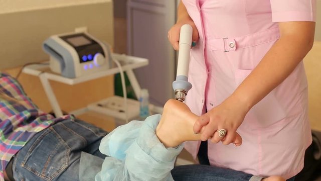 Close-up of a doctor doing shock wave therapy on a sore heel for a girl in a clinic. Physiotherapist doctor performs surgery on a patient's heel. Magnetic field, rehabilitation. Laser Therapy