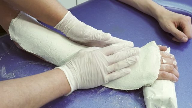 Doctor smooths out plaster bandage on arm patient in department of traumatology. He quickly puts firm dressings on skin carefully smoothing material, giving it body shape. Skilled expert dressed in
