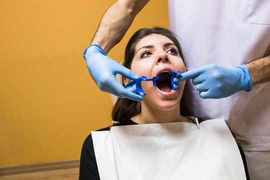 Unrecognizable dentist applying mouth expander to client for examine in cabinet.