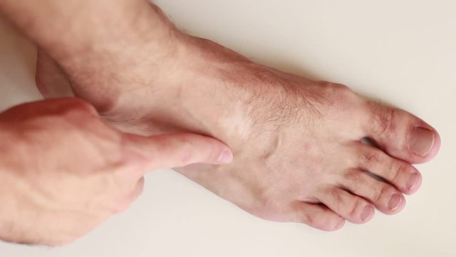 Touching vitiligo blotch on foot