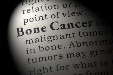 Obraz premium definition of Bone Cancer