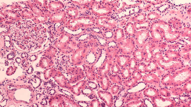 Kidney Histology: Histology of normal human kidney with collecting tubules and single glomerulus (left upper)