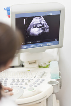 The doctor looked at the ultrasound screen with baby pictures.