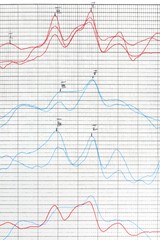 Hearing examination report. Tinnitus problem analysis.