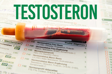 Testosteron / Blutprobe auf Laborzettel