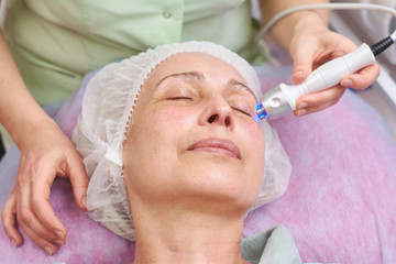 Mature female, rf skin tightening. Face of adult woman, cosmetology. Radio frequency treatment...