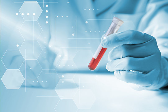 医療イメージ　血液検査