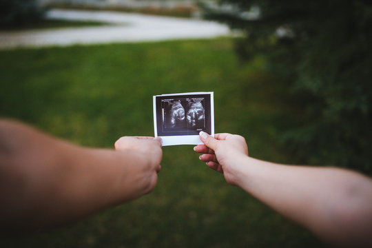 Ultrasound scan of baby in hands on green bakcground