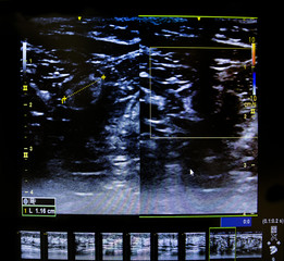 Colourful image of modern ultrasound monitor