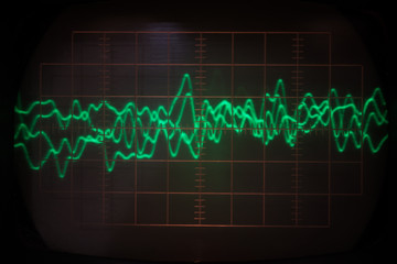 Reading a signal pulse on a classic oscilloscope