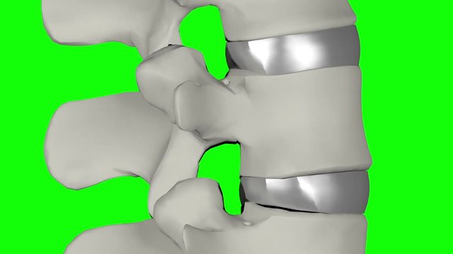 3d vertebra disc lumbar rotation movements