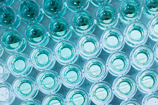 Assay Photos Royalty Free Images Graphics Vectors Videos Adobe Stock Assay Photos Royalty Free Images Graphics Vectors Videos Adobe Stock