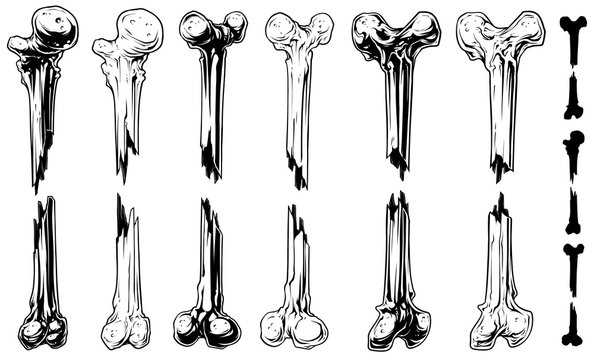 Graphic black and white broken bones vector set