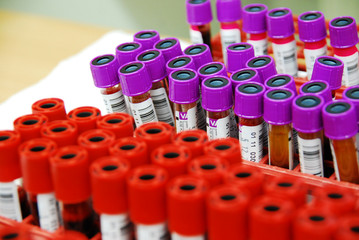 Blood samples in blood bank 