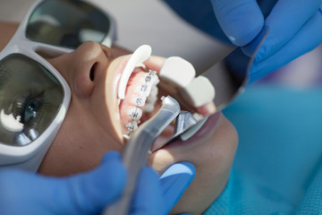 Dental laser used on a patient on soft and hard tissue. Dental health, modern technology and oral...