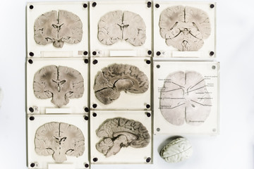 brain imaging section 