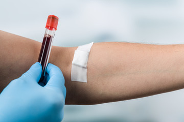 Nach Blutentnahme hält Hand Blutprobe vor einem Arm mit Pflaster
