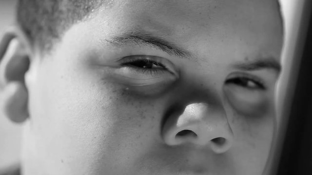 Close up of a boy squinting and looking at camera