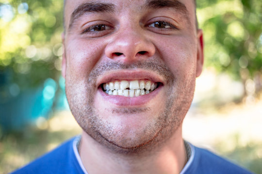 Young man in a blue T-shirt with a chipped tooth