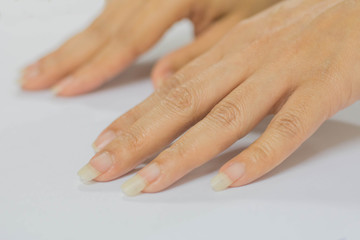 Nail and fingers