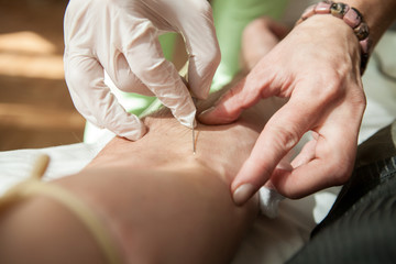 Hand with needle of medical dropper