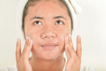Facial wash with acne