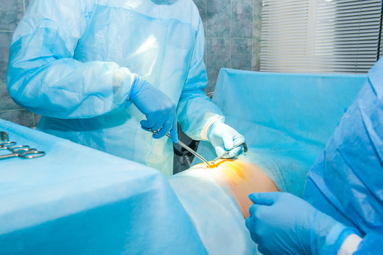 Close up hands of a surgeon and an assistant with instruments during surgery of abdominal cavity. Selective focus, space for text