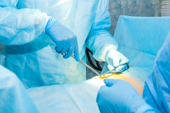 Close up hands of a surgeon and an assistant with instruments during surgery of abdominal cavity. Selective focus, space for text
