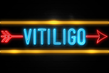 Vitiligo  - fluorescent Neon Sign on brickwall Front view