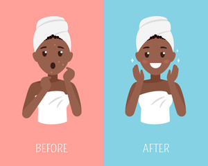 Black woman skin care. Before and after face treatment. Facial skin problems flat illustration