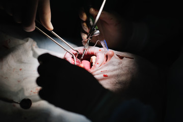 the surgeon makes a difficult dental surgery. Dentures