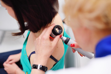 Doctor examining birthmarks and moles patient. examination of birthmarks and moles.the doctor...