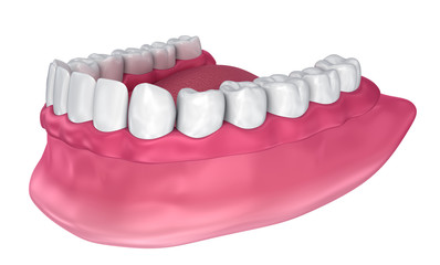 All missing teeth - removable full denture. 3D illustration