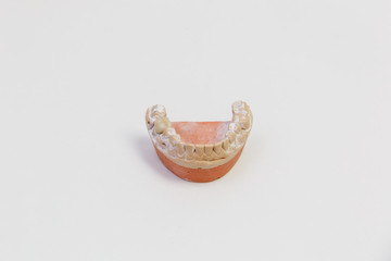 Cast of teeth isolated on white background. Denture, close up