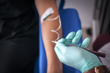 infermiere esegue un prelievo di sangue per analisi mediche
