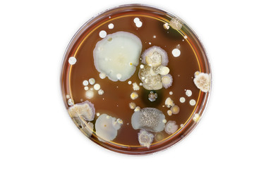 Petri dish with colonies of bacteria