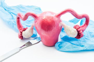 Concept of gynecology surgery. 3D model of female uterus is near scalpel and medical gloves. Surgery in gynecology and operation on uterus, ovaries or fallopian tubes such hysterectomy or myomectomy 