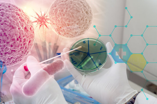Bacterial culture.