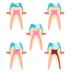 Stage of caries / Solid fill vector icon set of stage of caries
