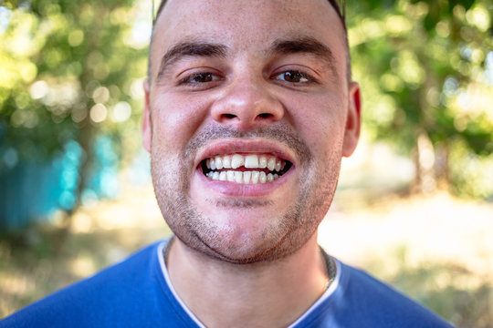 Young man in a blue T-shirt with a chipped tooth