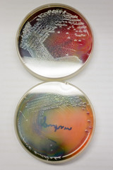 Close-up detail of multiple plates of Pseudomonas and Escherichia coli bacterial cultures from ICU sepsis patients at the laboratory. Healthcare and infectious diseases concept.