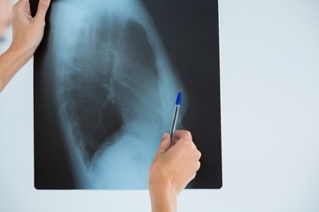 Cropped hand on female doctor examining X-ray - Powered by Adobe