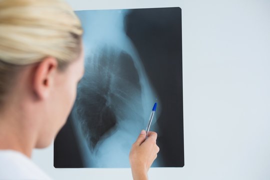Cropped image of female doctor examining X-ray