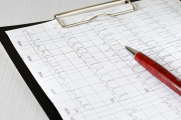 Electrocardiogram graph (ECG), heart analysis.  Black clipboard