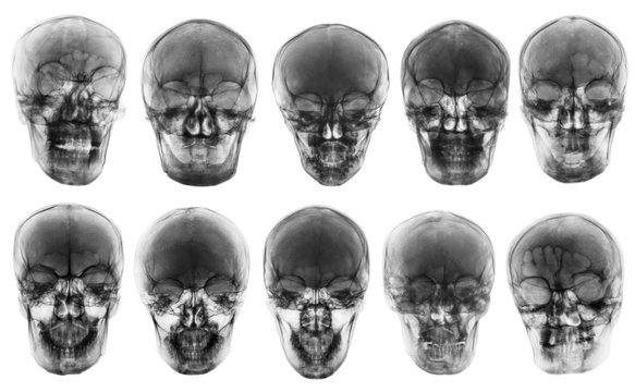 Collection of asian skull . front view  . isolated background